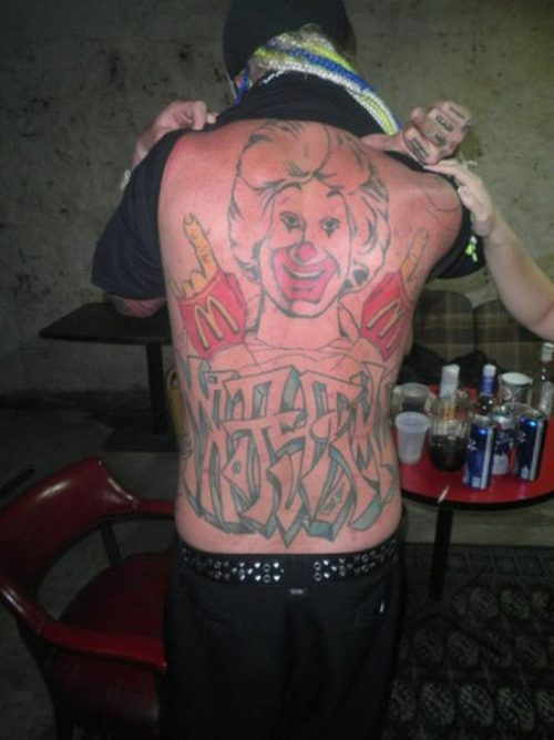 englishsurgeon.com. Photo showing a large unfortunate tattoo on the back. BCK Patel MD, FRCS, Salt Lake City
