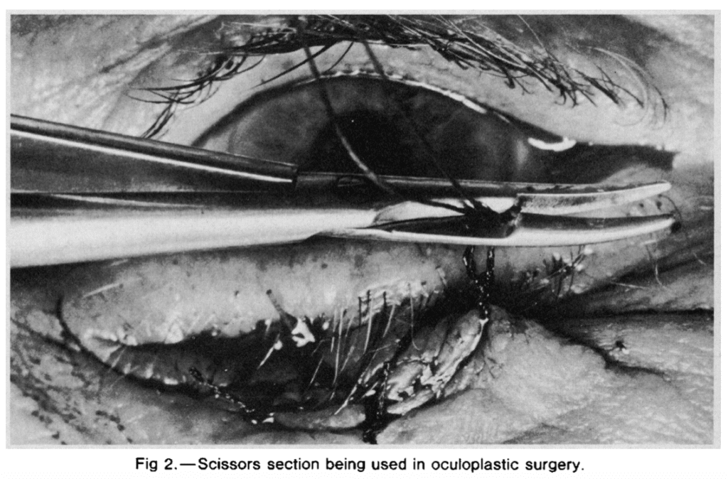 englishsurgeon.com. Photo showing the Patel Needleholders and scissors in use. BCK Patel MD, Salt Lake City, St. George