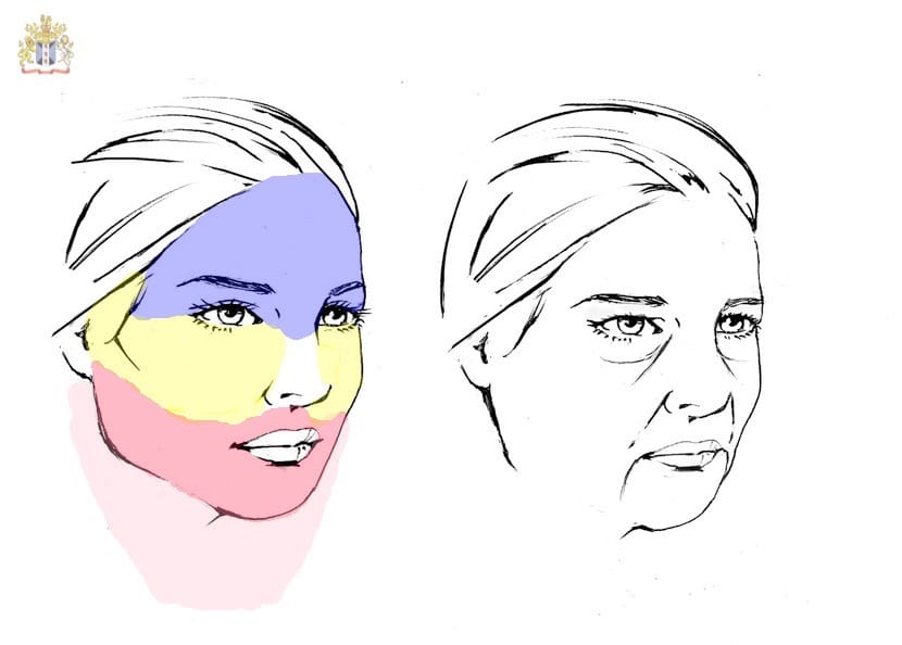 Facial aging changes that affect the forehead, the brows, the upper and lower eyelids, cheeks, lower face, jawline, jowls and neck that may benefit from a staged repair of the upper two-third of the face and a lower facelift and necklift by Dr. Bhupendra C.K. Patel MD of Salt Lake City, Saint George and London, England.